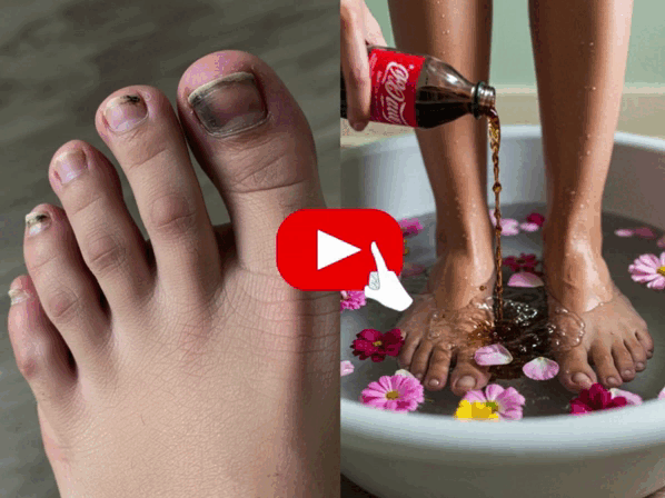 Click to Watch
